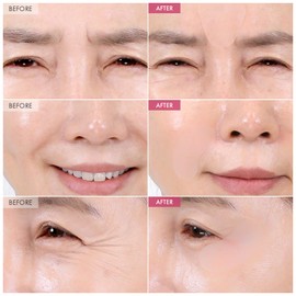 TOSOWOONG TOSOWOONG Anti-Wrinkle Patch with Hydrolyzed Collagen, Forehead & Eye & Smile Line Wrinkle Patches, Anti-Wrinkle Tape, K-Beauty Overnight Under Eye Patches, Korean Skincare, 5ea (10patches X 5)