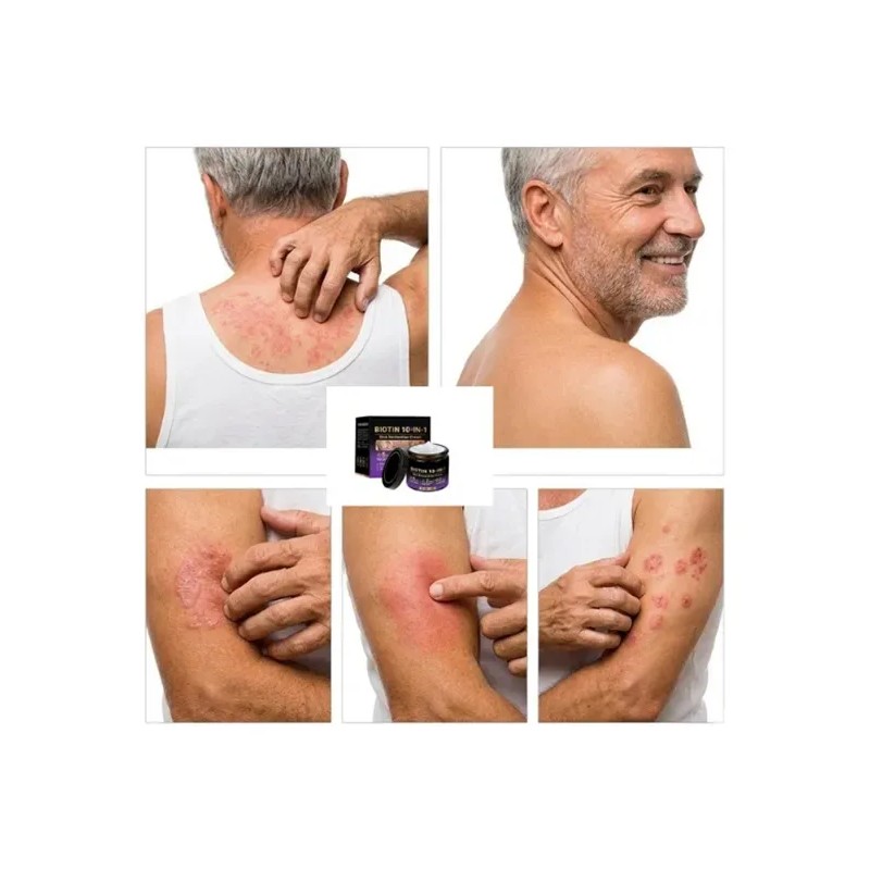 Crema Reparadora De La Piel Con Biotina 10 En 1,