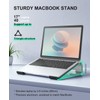 Soqool Laptop Stand for Desk, Ergonomic Detachable Laptop Riser, Aluminum