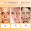 Baysea Turmeric Eye Stick for Dark Circles and Puffiness
