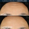 RoC Retinol Correxion Line Smoothing Night Retinol Serum, 80 Capsules
