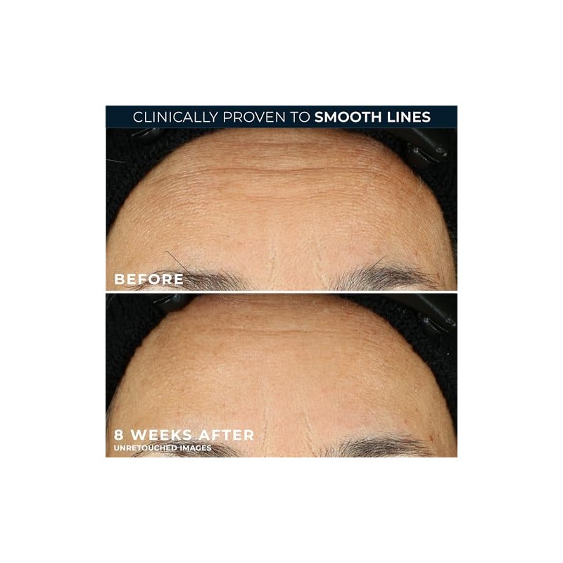 RoC Retinol Correxion Line Smoothing Night Retinol Serum, 80 Capsules