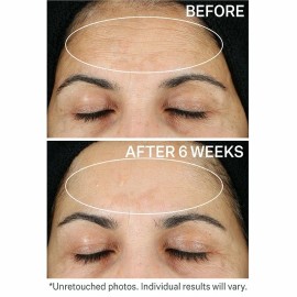 RETINOL MOISTURIZER DAY/NIGHT CREAM w/ Hyaluronic Acid - Highest Strength (2.5%)