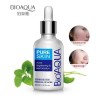 Tratamiento Acne Puntos Negros Manchas Cicatrices Barros