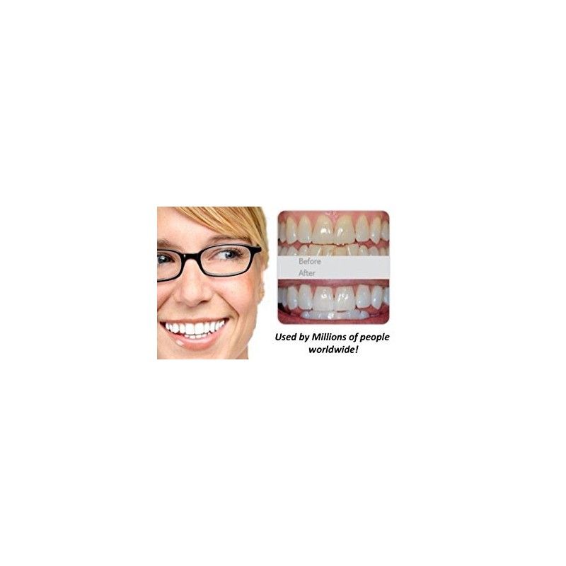 NiceWhites, Professional Teeth Whitening "Mini Blue" Light to Strengthen and