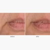 Freezeframe Wrinkle Block 30g