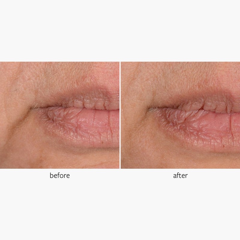 Freezeframe Wrinkle Block 30g