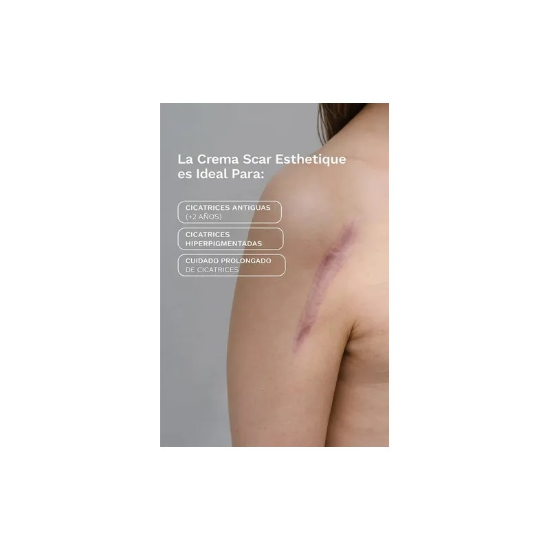 Rejuvaskin Esthetique Crema con Silicona para Cicatrices 30 ml