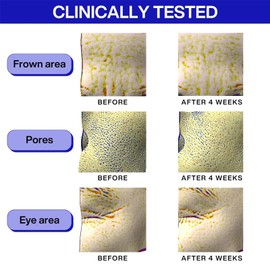 IOPE Retinol Super Bounce Serum | Korean Retinoid Eye Treatment for Anti-Aging, Beginner Friendly, Reduction in Fine Lines & Wrinkles, Firming and Rejuvenating, Daily Glow Routine, 1.69 Fl Oz. (50ml)