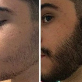 3x2 Tratamiento Pro Barba Bigote Rapido Seguro Novocrin 55gr