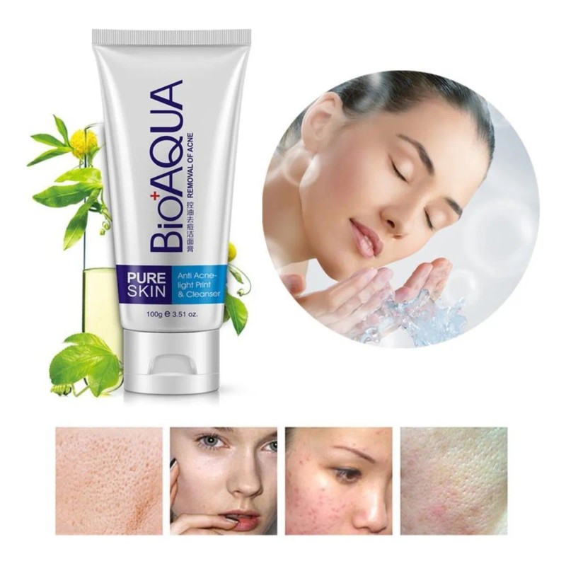 Jabón Bioaqua Acné Control Grasa Poros Puntos Negro Original Tipo
