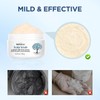 Bablabear- Exfoliante para el cuero cabelludo, tratamiento para la picazón