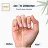 Nail Buffer Replacement Strips – Nail File & Restoration Kit