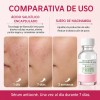 Sérum Bifásico Antiacné Puntos Rojos Y Espinillas Noche Weud