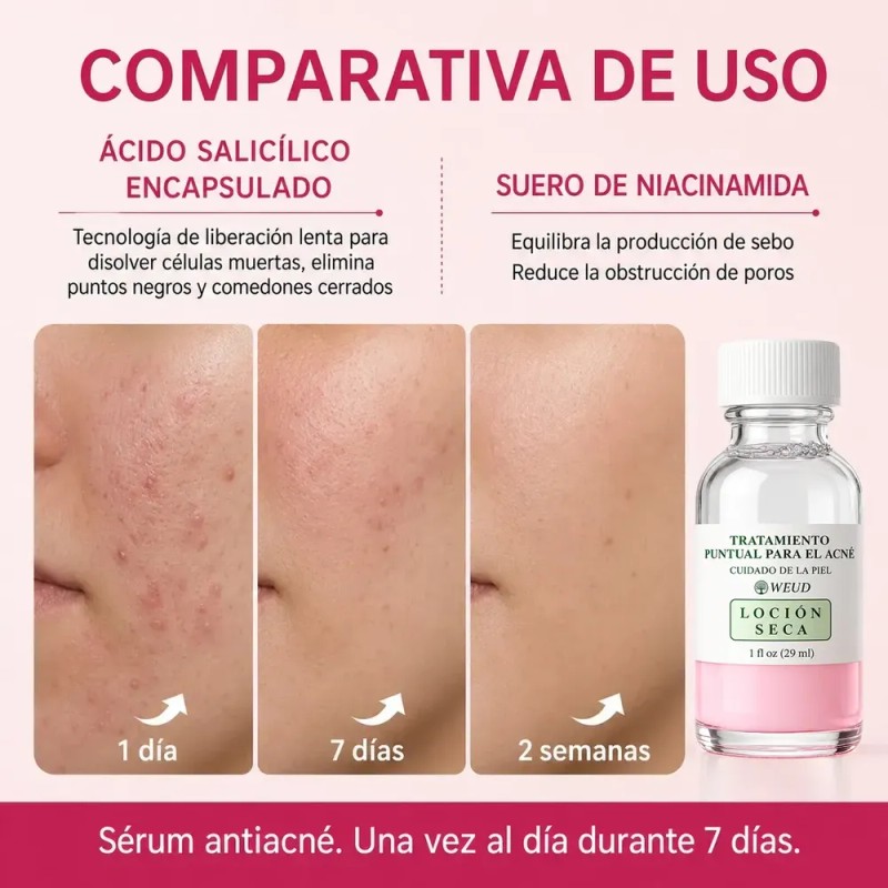 Sérum Bifásico Antiacné Puntos Rojos Y Espinillas Noche Weud