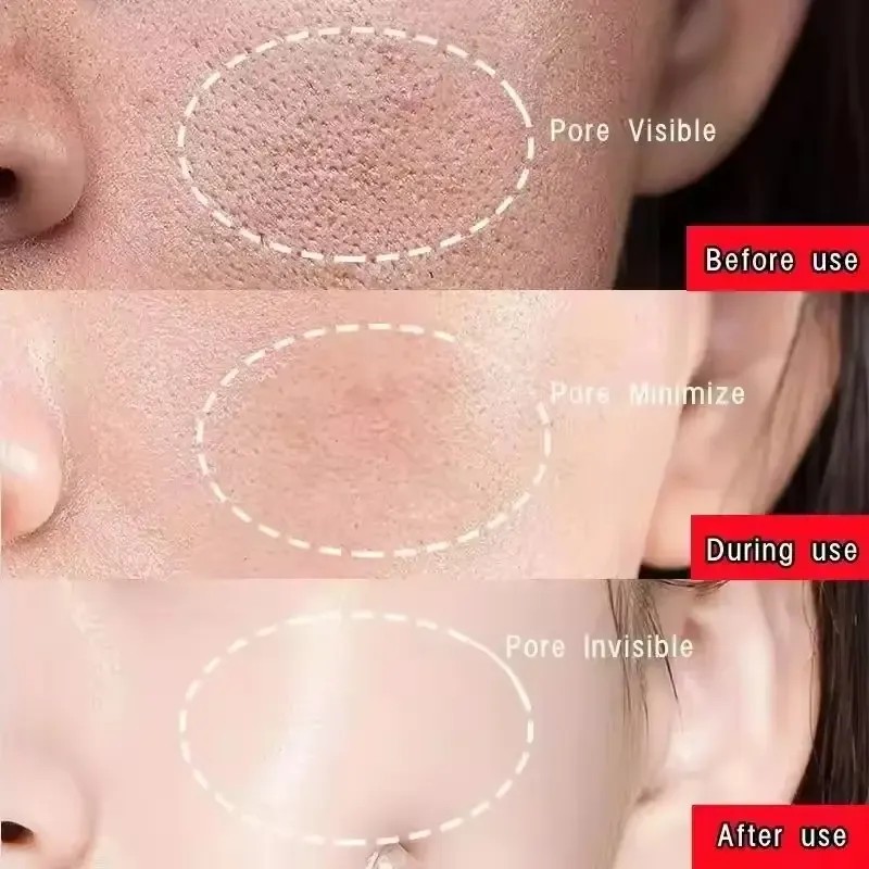 Mascarilla Sólida Limpia Poros Antiespinillas Control Grasa