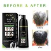 Champú para teñir el cabello Dexe de 14,1 onzas líquidas,