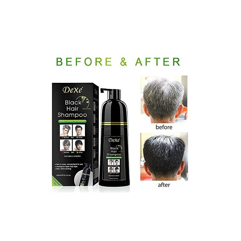 Champú para teñir el cabello Dexe de 14,1 onzas líquidas,
