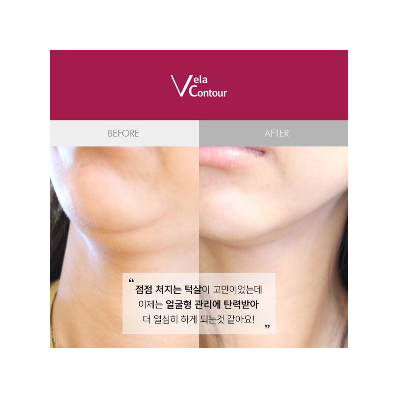 Anacis 아나시스 벨라컨투어 V 컨투어링 턱라인 넥케어 고톡스 앰플 30ml