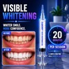 ZABERRY Teeth Whitening Kit with 2 x 10ml Gel +
