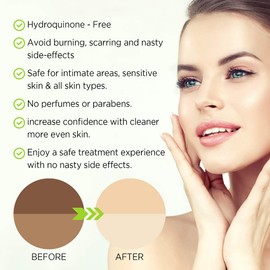 Lightening Serum with Kojic Acid, Dark Spot Corrector Remover for Face & Body, Natural Gentle Skin Brightening & Bleaching Cream, Lightens Private, Sensitive Areas 15ml by Evagloss