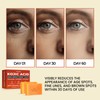 MONIER Kojic Acid Soap - Dark Spot Remover Soap Bars