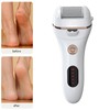 Foot Callus Remover Rechargeable 2 Levels Waterproof Speed Electronic Foot