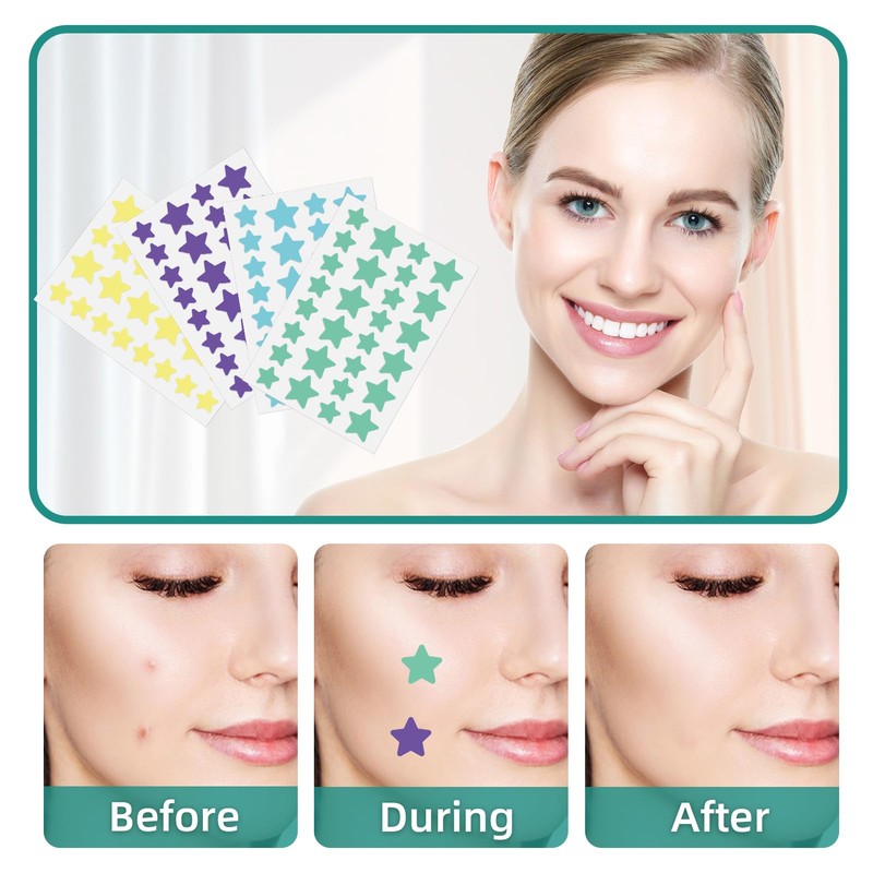 112 Counts Pimple Patch Stars, Star-Shaped Pimple Patch, Hydrocolloid Acne