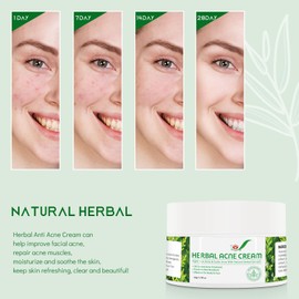 Tkekruh Face Cream (12)