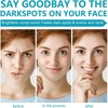 Dark Spot Remover for Face&Body,Dark Spot Correcting Cream,Dar/k Sp/ot Remover,Pigmentation