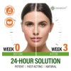 Crema Facial Para El Acné - Tratamiento Localizado Para El