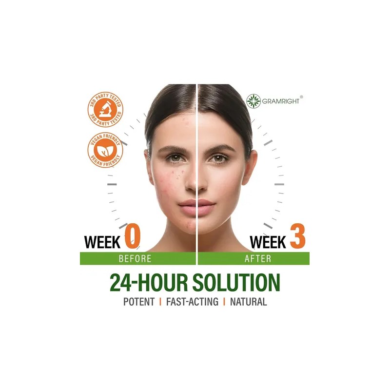 Crema Facial Para El Acné - Tratamiento Localizado Para El