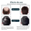 Esencia Anticaída Para El Cuidado Del Cabello Masculino-3pcs