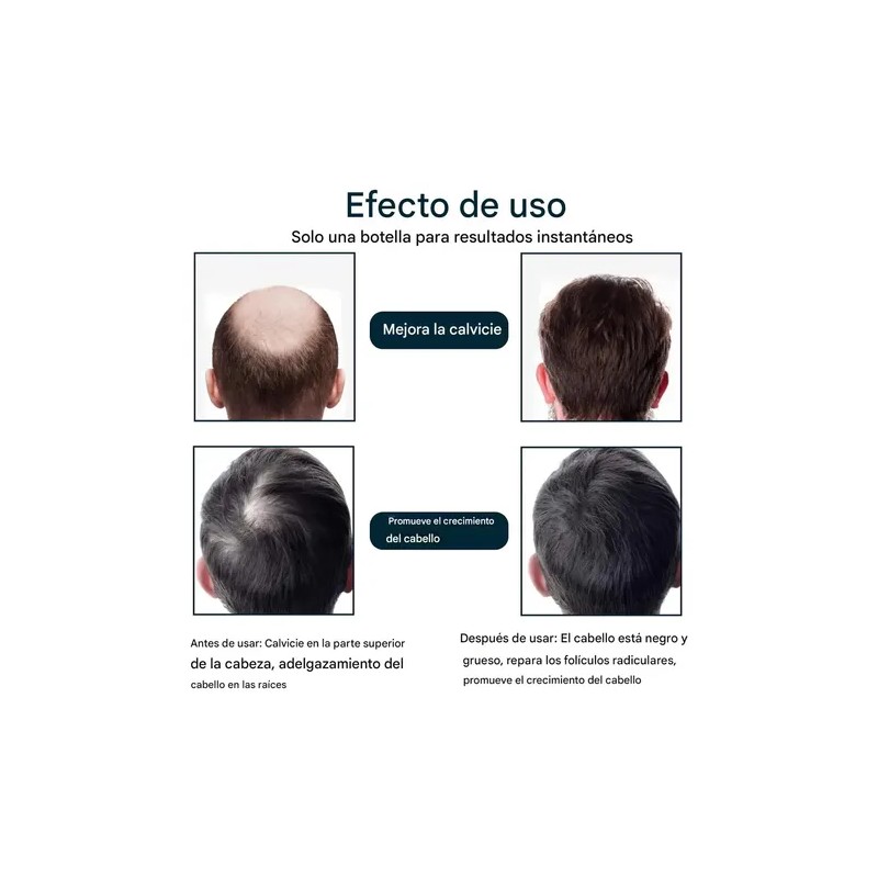 Esencia Anticaída Para El Cuidado Del Cabello Masculino-3pcs