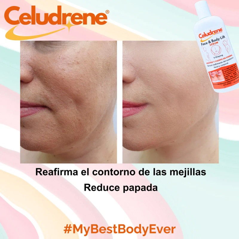 Serum Reductor De Papada Y Mejillas Celudrene 250 Ml