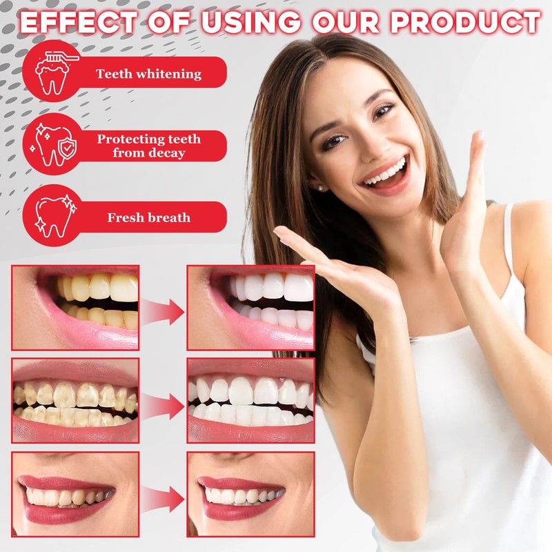 Pack of 2 Sp-6 Toothpaste, Sp-6 Probiotic Toothpaste, Whitening Toothpaste,