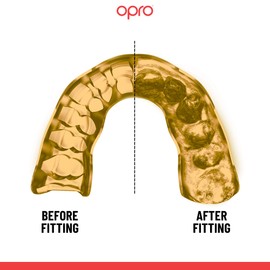 OPRO Instant Custom-Fit Mouthguard, Revolutionary Adjustment Technology for Ultimate Comfort and Protection, Gum Shield for Rugby, Boxing, Hockey, Martial Arts (France, Adult)