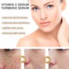 Vitamin C & Turmeric Face Serum For Aging & Wrinkles