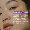 Pacifica Pore Warrior Everyday Face Lotion Acne Fighting - Niacinamide,