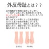 コモライフ 外反母趾やわらかパッド2足組 左右兼用 フリーサイズ 指間 広げる 痛み