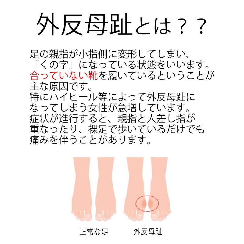 コモライフ 外反母趾やわらかパッド2足組 左右兼用 フリーサイズ 指間 広げる 痛み