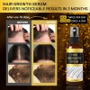 LEPHOQUA Hair Growth Oil Spray: Hair Growth Serum Spray with