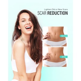 Silicone Scar Tape (1.57 * 120 Inches), Maskiss Silicone Scar Removal Sheets, Scar Tape for Surgical, Keloid, Burns, C-Section, Trauma, Silicone Tape for Scars Reusable, Professional Scar Treatment