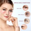 FANMIN Rose Under Eye Patches, Collagen Under Eye Mask For