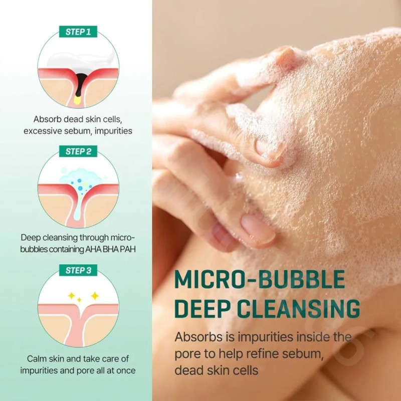 Aha Clear, 30 Días Milagrosos Para El Acné, Blanqueamiento D