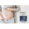 Sonogram Picture Frame - Weekly Fruit & Vegs Pregnancy Milestone,