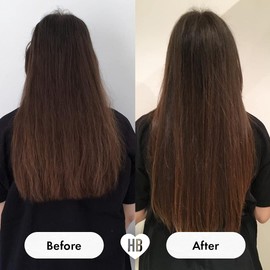 HAIR BURST Postpartum Vitamins For Hair Loss - Hairburst Pregnancy Supplements With Added Biotin, Folic Acid & B Vitamins - Breastfeeding For Prenatal & Postnatal Use - 30 Day Capsule Supply