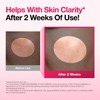 Lingtoolator Spot Correcting Serum / 10% Niacinamide+ 4% Tranexamic Acid,
