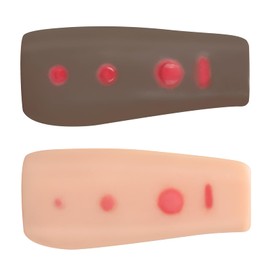 Ultrassist Tuberculosis(TB) Test Palpable Arm Set - Realistic Dual-Tone Training Model with Induration, Mantoux Method Forearm Simulation, Durable Silicone Practice Tool