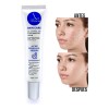 Crema Anti Acné Elimina Granos Espinillas Tratamiento 30g